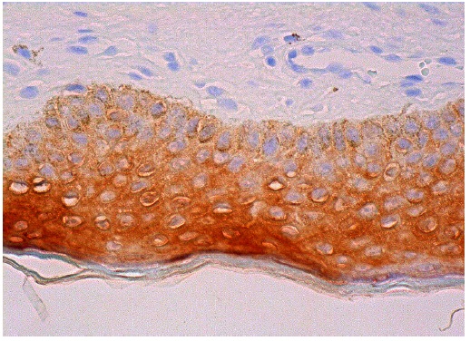  galectin-7 (A-8): sc-271473. Immunoperoxidase staining of formalin fixed, paraffin-embedded human vulva/anal skin tissue showing cytoplasmic staining of epidermal cells.