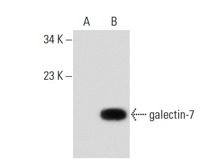  galectin-7 (F-3): sc-271472. Western blot analysis of galectin-7 expression in non-transfected: sc-117752 (A) and human galectin-7 transfected: sc-117240 (B) 293T whole cell lysates.