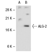  ALG-2 (H-14): sc-11255. Western blot analysis of ALG-2 expression in non-transfected: sc-117752 (A) and human ALG-2 transfected: sc-114742 (B) 293T whole cell lysates.