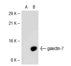  galectin-7 (H-60): sc-28253. Western blot analysis of galectin-7 expression in non-transfected: sc-117752 (A) and human galectin-7 transfected: sc-117240 (B) 293T whole cell lysates.