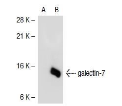  galectin-7 (D-18): sc-31796. Western blot analysis of galectin-7 expression in non-transfected: sc-117752 (A) and human galectin-7 transfected: sc-117240 (B) 293T whole cell lysates.