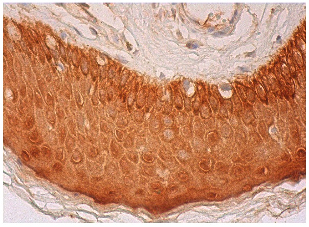  galectin-7 (N-17): sc-31794. Immunoperoxidase staining of formalin fixed, paraffin-embedded human vulva/anal skin tissue showing cytoplasmic and nuclear staining of epidermal cells.