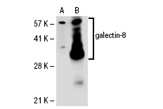  galectin-8 (H-80): sc-28254. Western blot analysis of galectin-8 expression in non-transfected: sc-110760 (A) and human galectin-8 transfected: sc-113277 (B) 293 whole cell lysates.