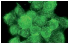  galectin-8 (H-80): sc-28254. Immunofluorescence staining of methanol-fixed HeLa cells showing cell surface localization.