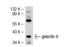  galectin-8 (H-80): sc-28254. Western blot analysis of galectin-8 expression in 293T whole cell lysate.