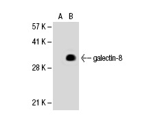  galectin-8 (D-18): sc-10265. Western blot analysis of galectin-8 expression in non-transfected: sc-110760 (A) and human galectin-8 transfected: sc-113277 (B) 293 whole cell lysates.