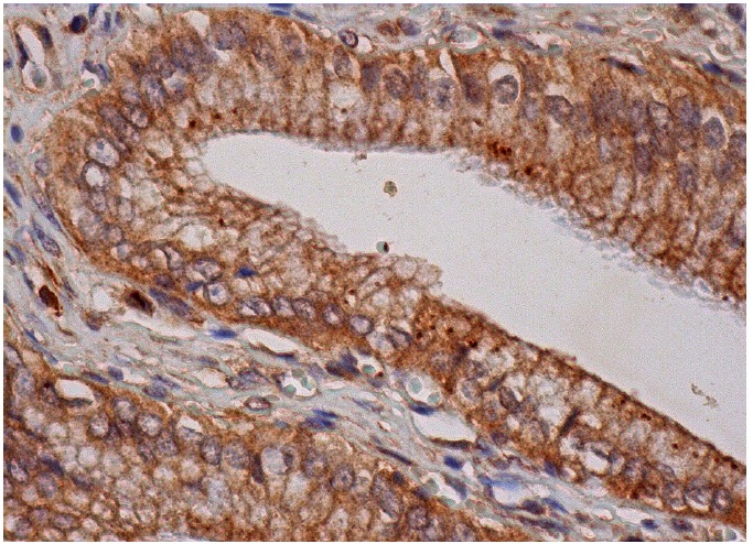  galectin-8 Antibody (D-18): sc-10265. Immunoperoxidase staining of formalin fixed, paraffin-embedded human gall bladder tissue showing cytoplasmic and membrane staining of glandular cells.