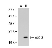  ALG-2 (AA8): sc-101209. Western blot analysis of ALG-2 expression in non-transfected: sc-117752 (A) and human ALG-2 transfected: sc-112988 (B) 293T whole cell lysates.