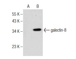  galectin-8 (C-8): sc-377133. Western blot analysis of galectin-8 expression in non-transfected: sc-110760 (A) and human galectin-8 transfected: sc-113277 (B) 293 whole cell lysates.