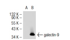  galectin-9 (M-20): sc-19294. Western blot analysis of galectin-9 expression in non-transfected: sc-117752 (A) and mouse galectin-9 transfected: sc-125369 (B) 293T whole cell lysates.