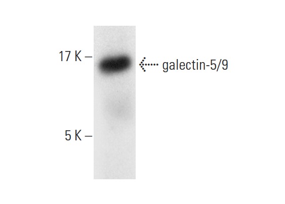  galectin-5/9 (R-145): sc-28252. Western blot analysis of galectin-5/9 expression in rat PBL whole cell lysate.