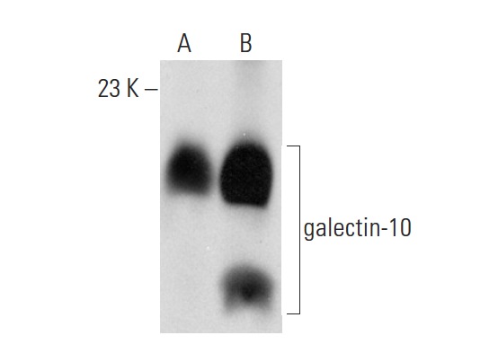  galectin-10 (FL-68): sc-68427. Western blot analysis of galectin-10 expression in mouse PBL whole cell lysate (A) and mouse spleen tissue extract (B).