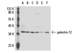  galectin-12 (G-20): sc-67579. Western blot analysis of galectin-12 expression in SK-BR-3 (A), Daudi (B), Raji (C), U-937 (D), Jurkat (E) and HeLa (F) whole cell lysates.