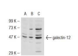  galectin-12 (H-166): sc-67294. Western blot analysis of galectin-12 expression in non-transfected 293T: sc-117752 (A), mouse galectin-12 transfected 293T: sc-120391 (B) and NIH/3T3 (C) whole cell lysates.