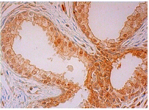  galectin-12 (E-19): sc-67578. Immunoperoxidase staining of formalin fixed, paraffin-embedded human prostate tissue showing nuclear and cytoplasmic staining of glandular cells.