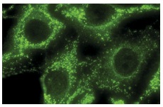  Ganglioside GD3 (MB3.6): sc-33685. Immunofluorescence staining of methanol-fixed SK-MEL-28 cells showing cytoplasmic localization.