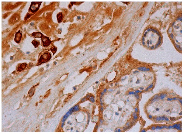  Gas1 (C-17): sc-9585. Immunoperoxidase staining of formalin fixed, paraffin-embedded human placenta tissue showing cytoplasmic staining of trophoblastic cells and decidual cells.