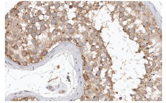  Gas1 (C-17): sc-9585. Immunoperoxidase staining of formalin fixed, paraffin-embedded human testis tissue showing cytoplasmic staining of cell in seminiferus ducs & Leydig cells at high magnification. Kindly provided by The Swedish Human Protein Atlas (HPA) program.