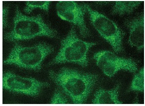  Gas6 (H-140): sc-22759. Immunofluorescence staining of methanol-fixed HeLa cells showing cytoplasmic localization.