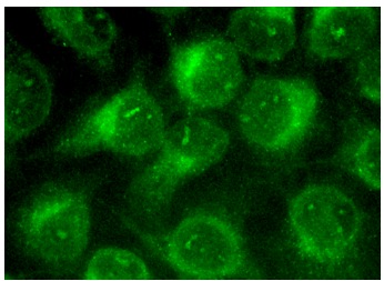  gasdermin (H-6): sc-376318. Immunofluorescence staining of methanol-fixed HeLa cells showing cytoplasmic localization.