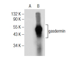  gasdermin (H-6): sc-376318. Western blot analysis of gasdermin expression in non-transfected: sc-110760 (A) and mouse gasdermin transfected: sc-178656 (B) 293 whole cell lysates.