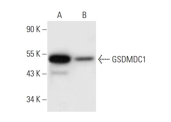  GSDMDC1 (A-7): sc-393656. Western blot analysis of GSDMDC1 expression in RAW 264.7 (A) and WEHI-3 (B) whole cell lysates.