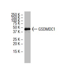  GSDMDC1 (64-Y): sc-81868. Western blot analysis of GSDMDC1 expression in Jurkat whole cell lysate.