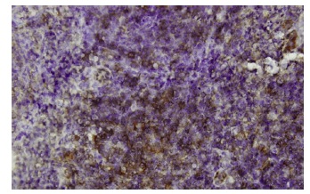  GSDMDC1 (64-Y): sc-81868. Immunoperoxidase staining of formalin-fixed, paraffin-embedded human tonsil tissue showing cytoplasmic localization.