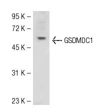  GSDMDC1 (64-Y): sc-81868. Western blot analysis of GSDMDC1 expression in Jurkat whole cell lysate.