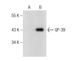  GP-39 (D-6): sc-376941. Western blot analysis of GP-39 expression in non-transfected: sc-117752 (A) and mouse GP-39 transfected: sc-120569 (B) 293T whole cell lysates.