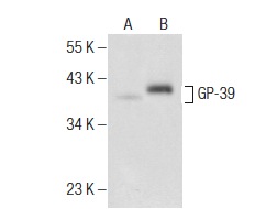  GP-39 (E-11): sc-376910. Western blot analysis of GP-39 expression in non-transfected: sc-117752 (A) and mouse GP-39 transfected: sc-120569 (B) 293T whole cell lysates.