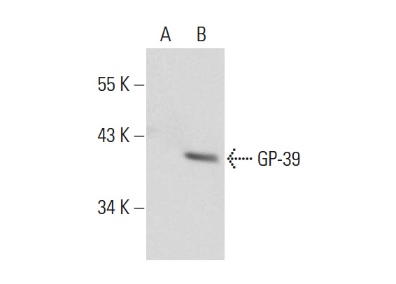  GP-39 (M-43): sc-98954. Western blot analysis of GP-39 expression in non-transfected: sc-117752 (A) and mouse GP-39 transfected: sc-120569 (B) 293T whole cell lysates.