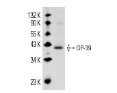  GP-39 (M-20): sc-30861. Western blot analysis of GP-39 expression in postnatal mouse liver tissue extract.