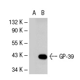  GP-39 (M-20): sc-30861. Western blot analysis of GP-39 expression in non-transfected: sc-117752 (A) and mouse GP-39 transfected: sc-120569 (B) 293T whole cell lysates.