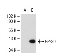  GP-39 (M-20): sc-30861. Western blot analysis of GP-39 expression in non-transfected: sc-117752 (A) and mouse GP-39 transfected: sc-120571 (B) 293T whole cell lysates.