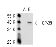  GP-39 (M-20): sc-30861. Western blot analysis of GP-39 expression in non-transfected: sc-117752 (A) and mouse GP-39 transfected: sc-120570 (B) 293T whole cell lysates.