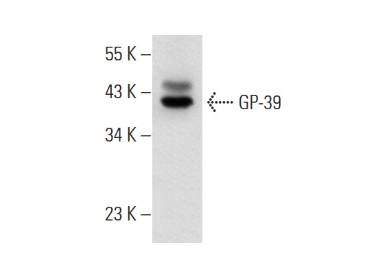  GP-39 (M-20): sc-30861. Western blot analysis of GP-39 expression in rat liver tissue extract.