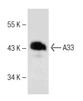  A33 (T-19): sc-33011. Western blot analysis of A33 expression in human colon tissue extract.