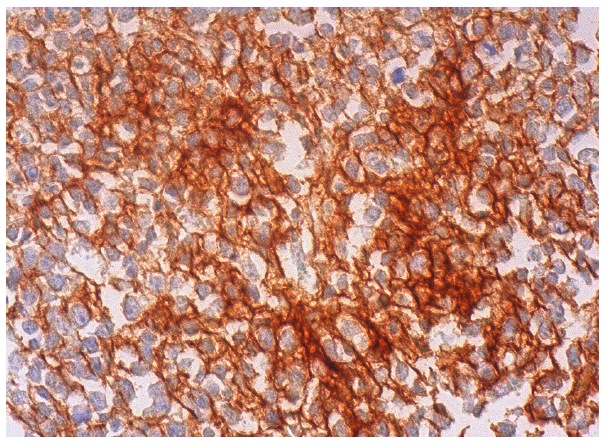  granzyme H (K-14): sc-47026. Immunoperoxidase staining of formalin fixed, paraffin-embedded human lymph node tissue showing cytoplasmic and membrane staining of cells in non-germinal centers.