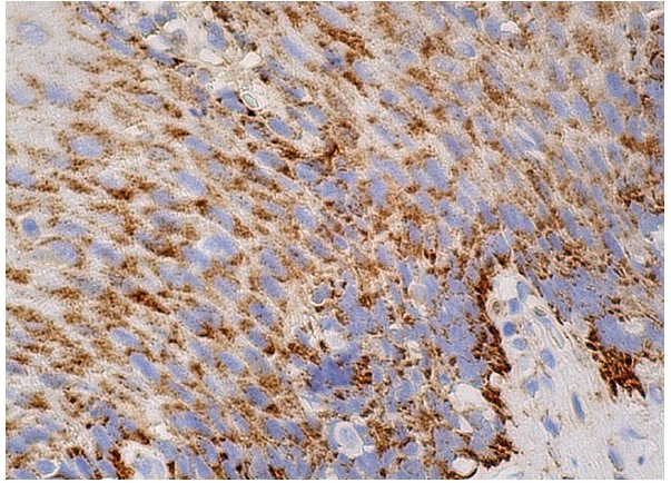  Grim19 (F-10): sc-365978. Immunoperoxidase staining of formalin fixed, paraffin-embedded human esophagus tissue showing cytoplasmic staining of squamous epithelial cells. 