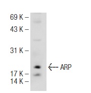  ARP (C-19): sc-34560. Western blot analysis of ARP expression in C32 whole cell lysate.