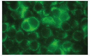  Grim19 (C-1): sc-271013. Immunofluorescence staining of methanol-fixed HeLa cells showing cytoplasmic localization.