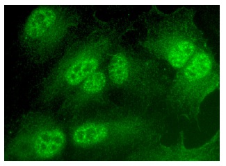  Grim19 (H-71): sc-99086. Immunofluorescence staining of formalin-fixed Hep G2 cells showing nuclear and cytoplasmic localization.