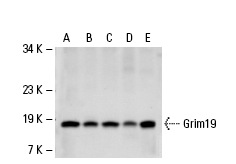  Grim19 (1A8): sc-66195. Western blot analysis of Grim19 expression in HeLa (A), Jurkat (B), Ramos (C), human PBL (D) and Hep G2 (E) whole cell lysates.