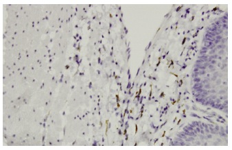  Gros1 (F-07): sc-101240. Immunoperoxidase staining of formalin-fixed, paraffin-embedded human esophagus tissue showing cytoplasmic localization.