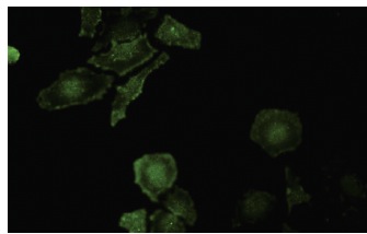  Gros1 (F-07): sc-101240. Immunofluorescence staining of paraformaldehyde-fixed HeLa cells showing membrane and cytoplasmic localization.