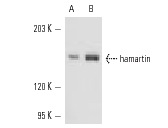  hamartin (C-20): sc-12082. Western blot analysis of hamartin expression in MDA-MB-231 (A) and MDA-MB-468 (B) whole cell lysates.