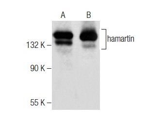  hamartin (C-8): sc-377386. Western blot analysis of hamartin expression in SJRH30 (A) and IMR-32 (B) whole cell lysates.