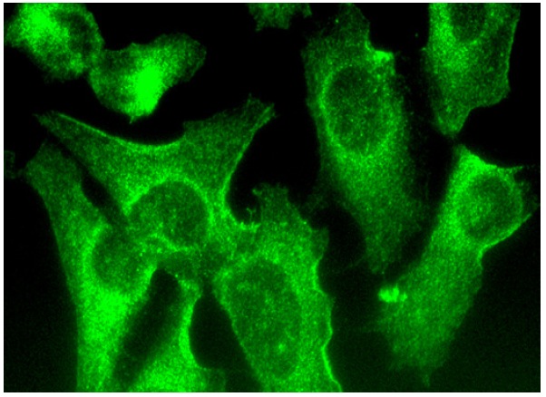  hamartin (C-8): sc-377386. Immunofluorescence staining of methanol-fixed HeLa cells showing cytoplasmic and membrane localization.