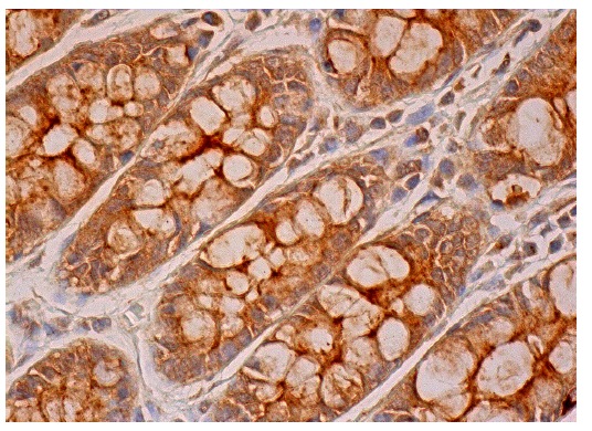  A33 (T-19): sc-33011. Immunoperoxidase staining of formalin fixed, paraffin-embedded human rectum tissue showing cytoplasmic and membrane staining of glandular cells.